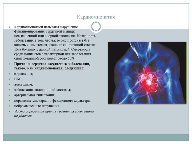 Кардиомиопатия Кардиомиопатией называют нарушение функционирования сердечной мышцы невыясненной или спорной этиологии