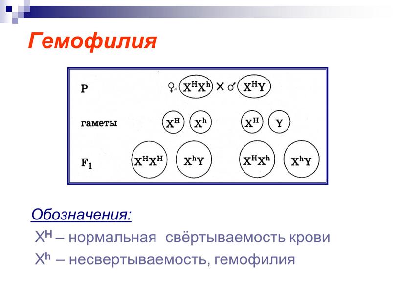 Гемофилия Обозначения: Х Н – нормальная свёртываемость крови