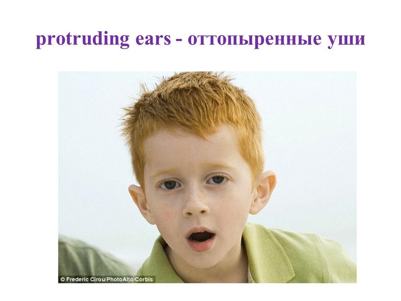 protruding ears - оттопыренные уши