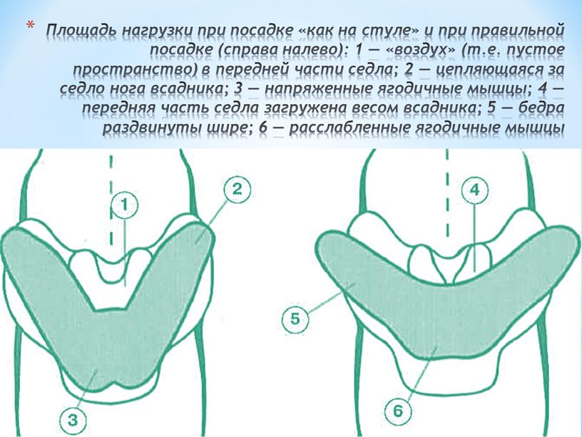 Площадь нагрузки при посадке «как на стуле» и при правильной посадке (справа налево): 1 — «воздух» (т