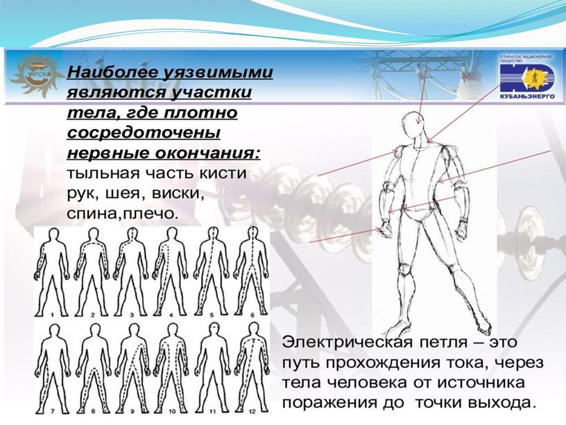 Презентация "Электротравма" для занятий по МБО БЖ для СПО