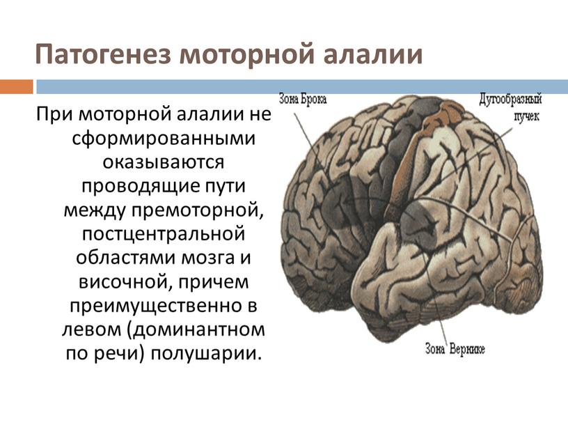 Патогенез моторной алалии При моторной алалии не сформированными оказываются проводящие пути между премоторной, постцентральной областями мозга и височной, причем преимущественно в левом (доминантном по речи)…