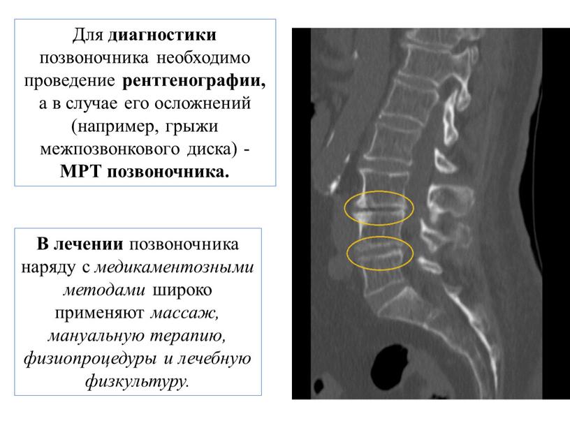 Для диагностики позвоночника необходимо проведение рентгенографии, а в случае его осложнений (например, грыжи межпозвонкового диска) -