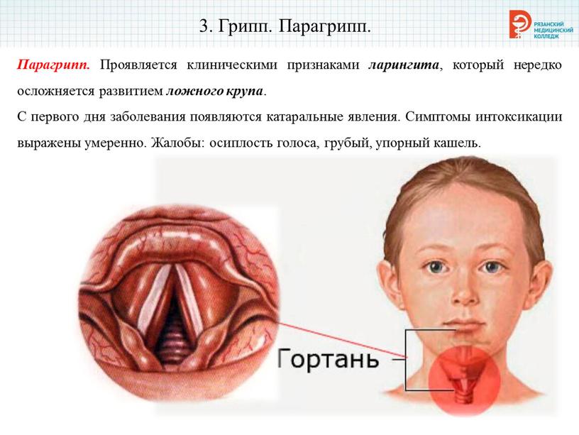 Грипп. Парагрипп. Парагрипп.