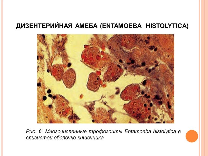 ДИЗЕНТЕРИЙНАЯ АМЕБА (ENTAMOEBA