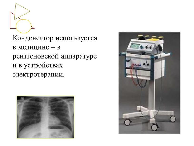 Конденсатор используется в медицине – в рентгеновской аппаратуре и в устройствах электротерапии