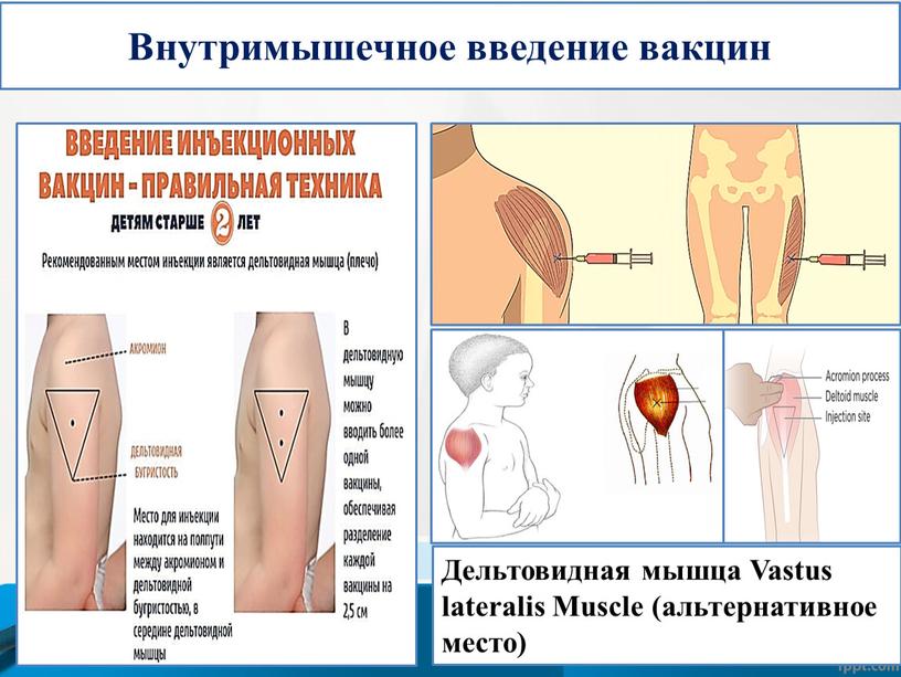 Внутримышечное введение вакцин