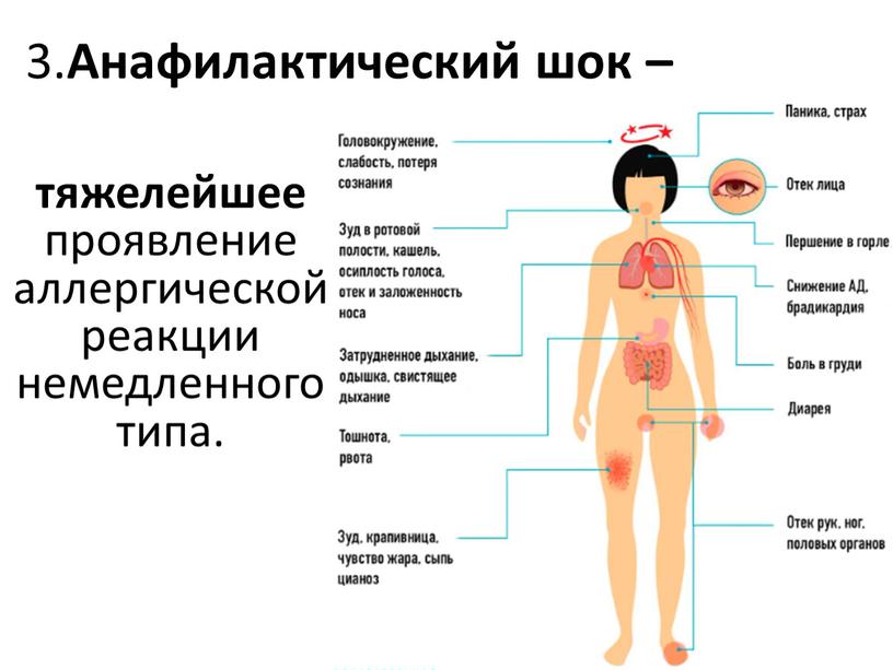 тяжелейшее проявление аллергической реакции немедленного типа. 3. Анафилактический шок –