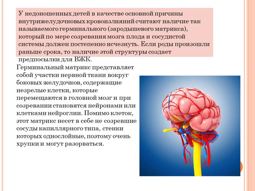 У недоношенных детей в качестве основной причины внутрижелудочковых кровоизлияний считают наличие так называемого герминального (зародышевого матрикса), который по мере созревания мозга плода и сосудистой системы…