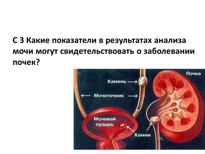 С 3 Какие показатели в результатах анализа мочи могут свидетельствовать о заболевании почек?