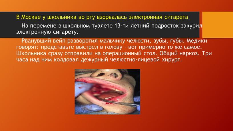 В Москве у школьника во рту взорвалась электронная сигарета
