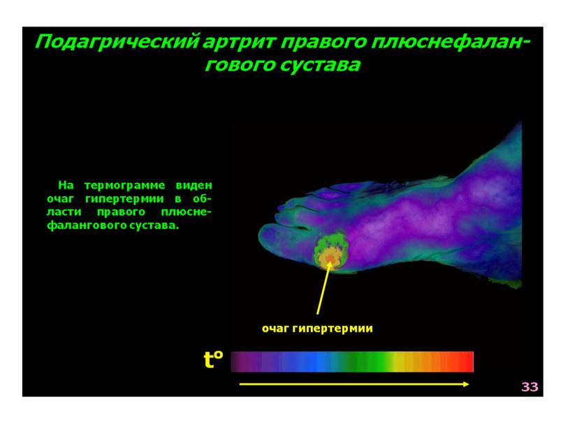 НАРУШЕНИЯ ОБМЕНА ВЕЩЕСТВ