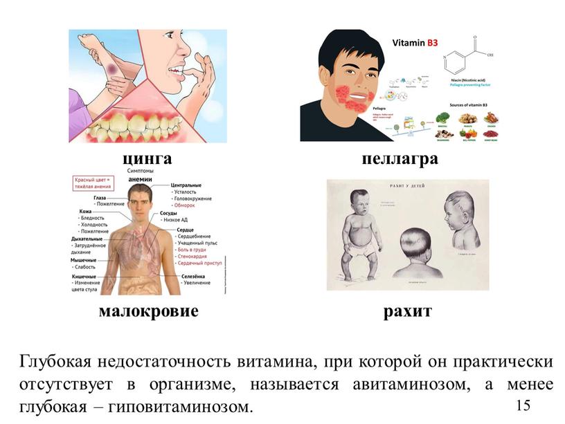 Глубокая недостаточность витамина, при которой он практически отсутствует в организме, называется авитаминозом, а менее глубокая – гиповитаминозом