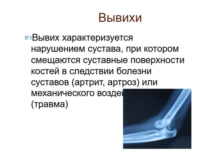 Оказание первой помощи при переломах