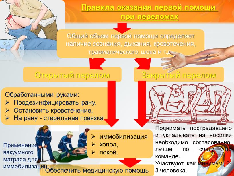 Открытый перелом Обработанными руками: