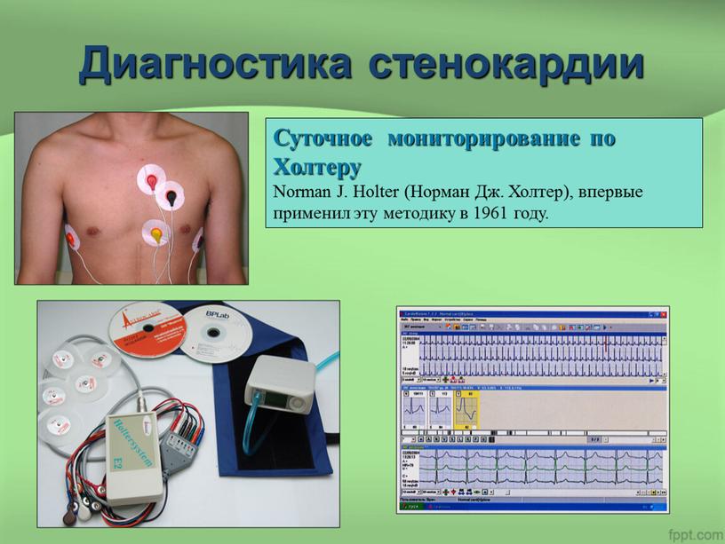 Диагностика стенокардии Суточное мониторирование по