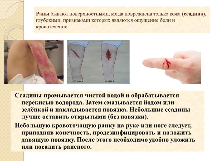Раны бывают поверхностными, когда повреждена только кожа ( ссадина ), глубокими, признаками которых являются ощущение боли и кровотечение
