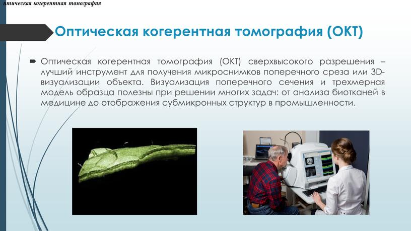 Оптическая когерентная томография (ОКТ)