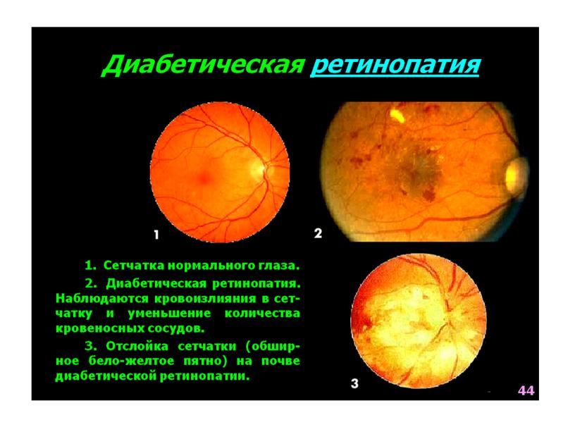 НАРУШЕНИЯ ОБМЕНА ВЕЩЕСТВ