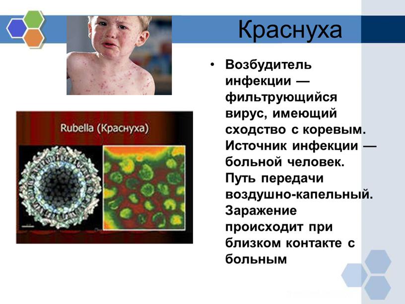 Краснуха Возбудитель инфекции — фильтрующийся вирус, имеющий сходство с коревым