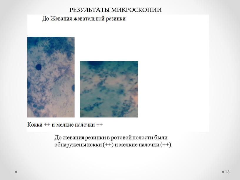 До жевания резинки в ротовой полости были обнаружены кокки (++) и мелкие палочки (++)