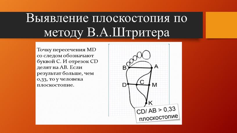 Выявление плоскостопия по методу