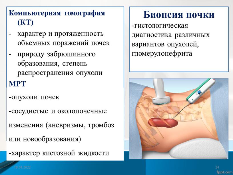 Компьютерная томография (КТ) характер и протяженность объемных поражений почек природу забрюшинного образования, степень распространения опухоли