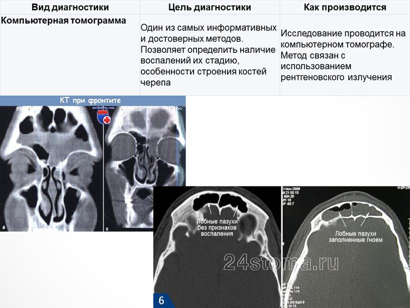 Вид диагностики Цель диагностики