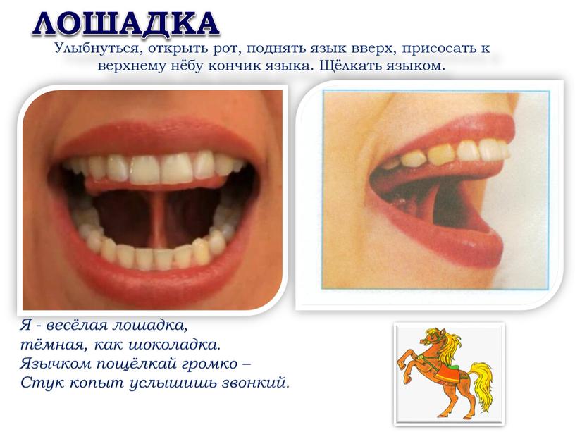 ЛОШАДКА Улыбнуться, открыть рот, поднять язык вверх, присосать к верхнему нёбу кончик языка