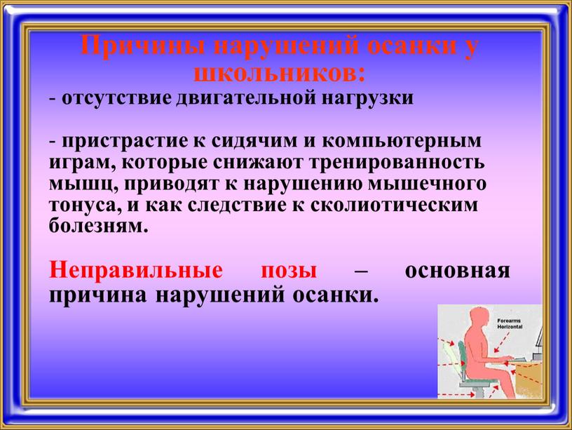 Причины нарушений осанки у школьников: отсутствие двигательной нагрузки пристрастие к сидячим и компьютерным играм, которые снижают тренированность мышц, приводят к нарушению мышечного тонуса, и как…