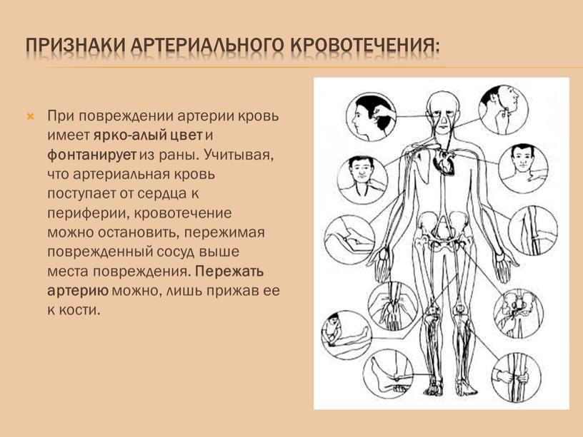 Признаки артериального кровотечения: