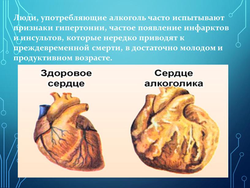 Люди, употребляющие алкоголь часто испытывают признаки гипертонии, частое появление инфарктов и инсультов, которые нередко приводят к преждевременной смерти, в достаточно молодом и продуктивном возрасте