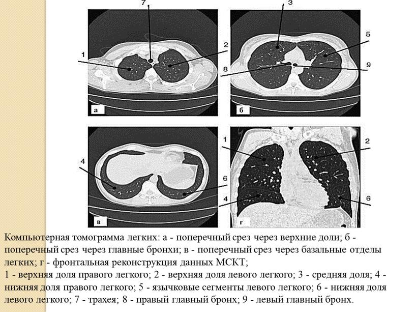 Схема легких кт