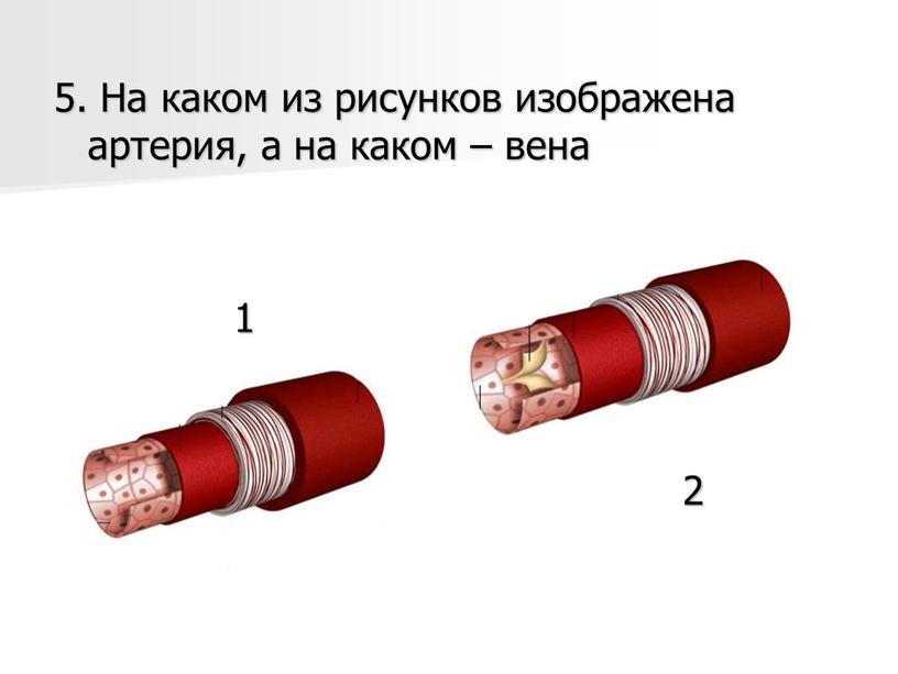 На каком из рисунков изображена артерия, а на каком – вена 1 2