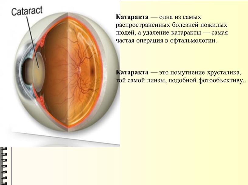 Катаракта — одна из самых распространенных болезней пожилых людей, а удаление катаракты — самая частая операция в офтальмологии