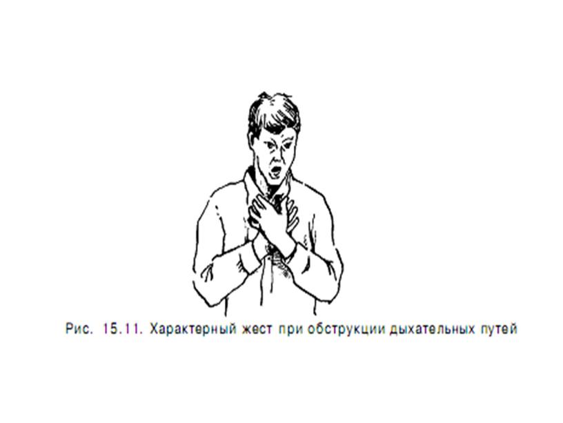 НОРМАТИВНО – ПРАВОВЫЕ АСПЕКТЫ ОКАЗАНИЯ ПОМОЩИ.БАЗОВЫЕ РЕАНИМАЦИОННЫЕ МЕРОПРИЯТИЯ