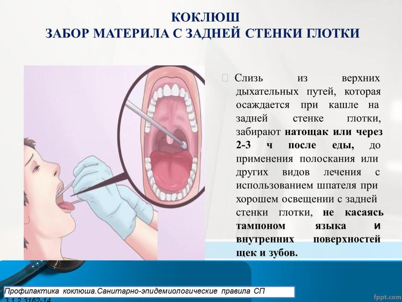 КОКЛЮШ ЗАБОР МАТЕРИЛА С ЗАДНЕЙ