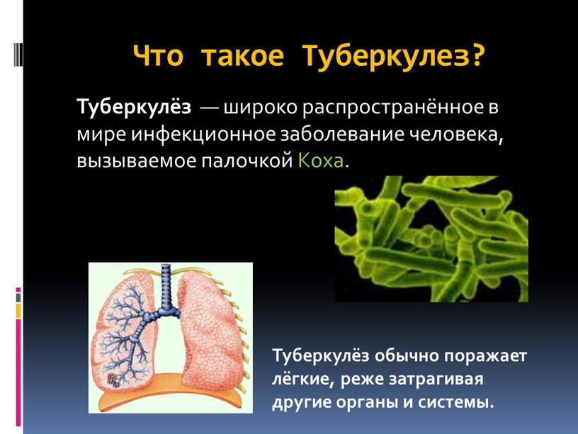Что такое Туберкулез? Туберкулёз — широко распространённое в мире инфекционное заболевание человека, вызываемое палочкой