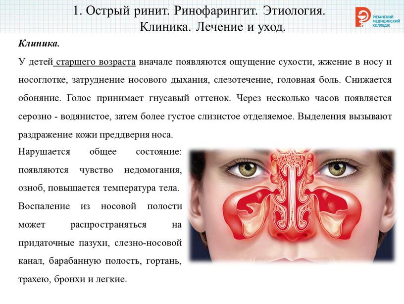 Острый ринит. Ринофарингит. Этиология