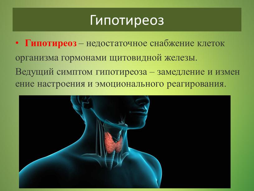 Гипотиреоз Гипотиреоз – недостаточное снабжение клеток организма гормонами щитовидной железы