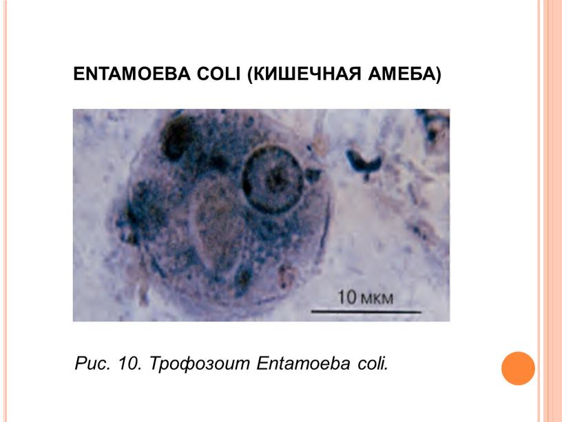 ENTAMOEBA COLI (КИШЕЧНАЯ АМЕБА)