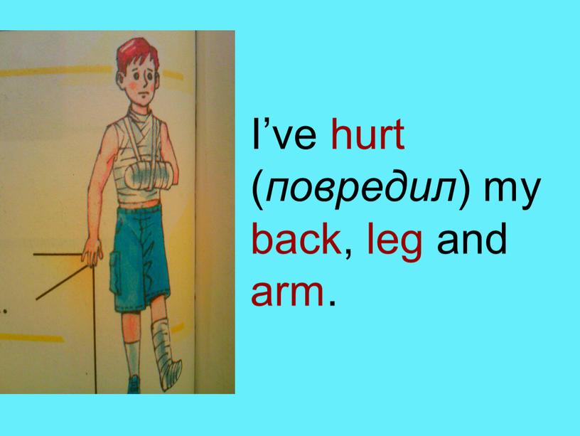 I’ve hurt ( повредил ) my back, leg and arm