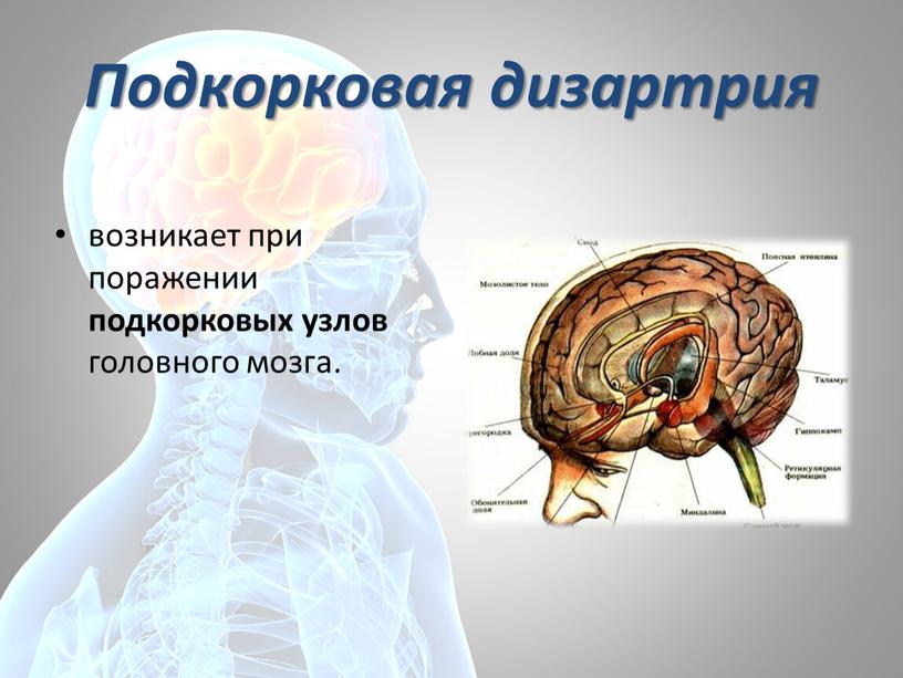 Подкорковая дизартрия возникает при поражении подкорковых узлов головного мозга