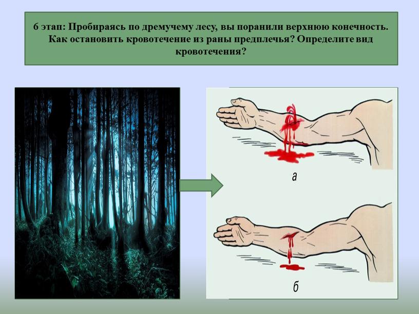 Пробираясь по дремучему лесу, вы поранили верхнюю конечность