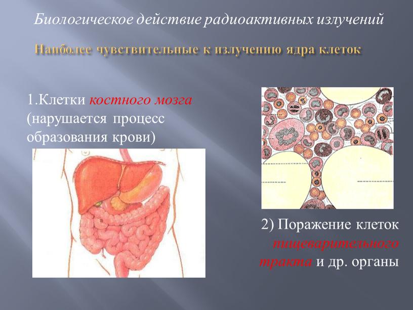 Наиболее чувствительные к излучению ядра клеток 1