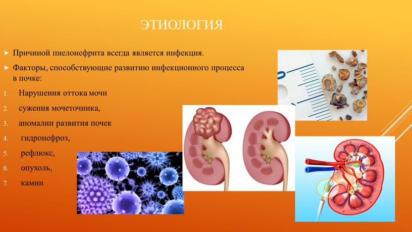 Этиология Причиной пиелонефрита всегда является инфекция