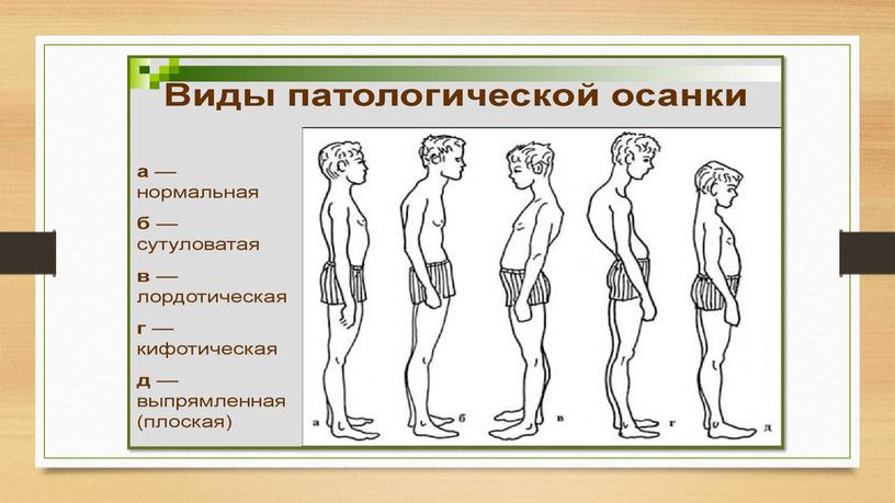 Презентация: "Профилактика нарушений опорно-двигательного аппарата у дошкольников"