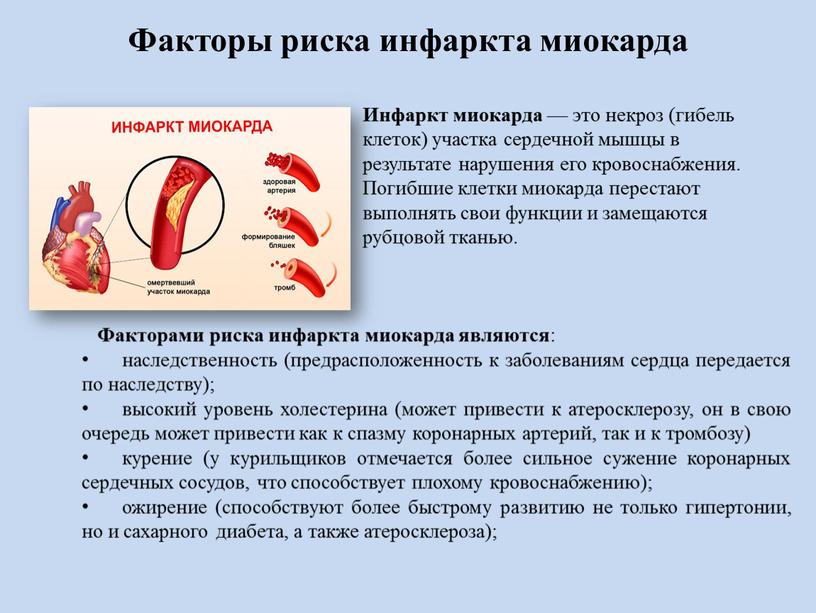 Инфаркт миокарда — это некроз (гибель клеток) участка сердечной мышцы в результате нарушения его кровоснабжения