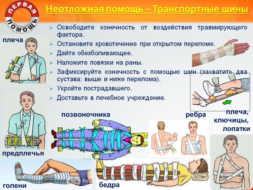 Неотложная помощь – Транспортные шины плеча голени предплечья бедра