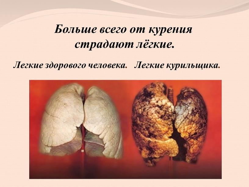 Больше всего от курения страдают лёгкие